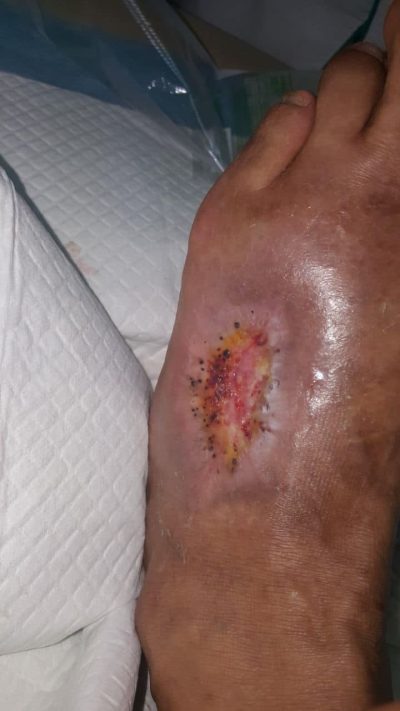 The wound on the date of publication: February 10, 2018